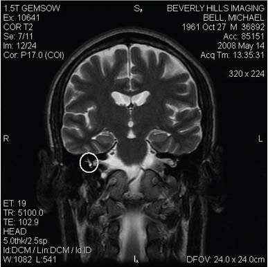 MRI image